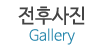 전후사진