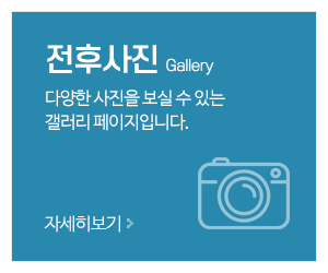 제일쇼파천갈이_메인중간_전후사진